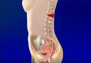 site de rencontre pour personne incontinente