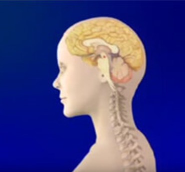 Incontinence urinaire par instabilité vésicale