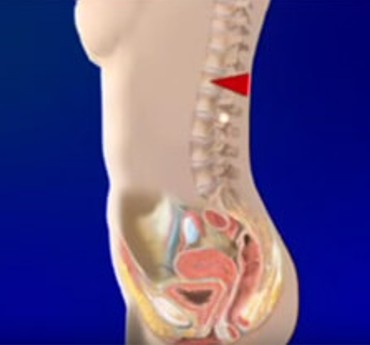 Incontinence urinaire par réflexe